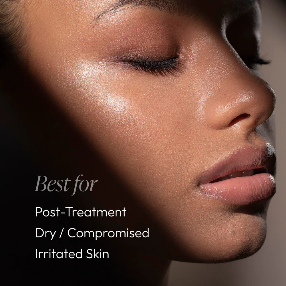 Post Treatment Balm (Formerly Post Peel Balm)